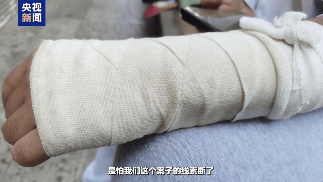 被游客掰断手臂的NPC系一级运动员 被游客掰断手臂的NPC系一级运动员